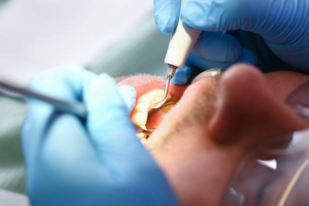 Best Emergency Dentist for Knocked-Out Tooth in New Eagle, PA